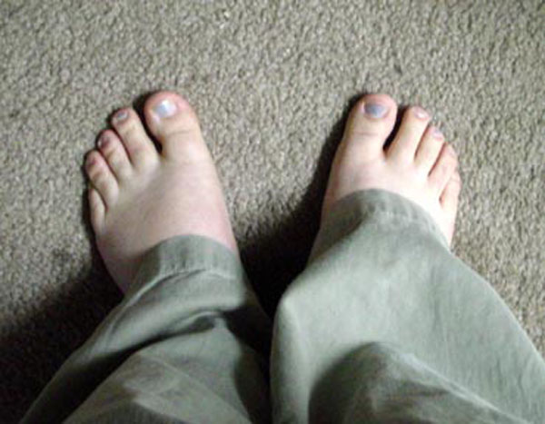 Mandie's Feet (February 2003)